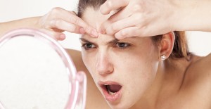 4 tips mot acne