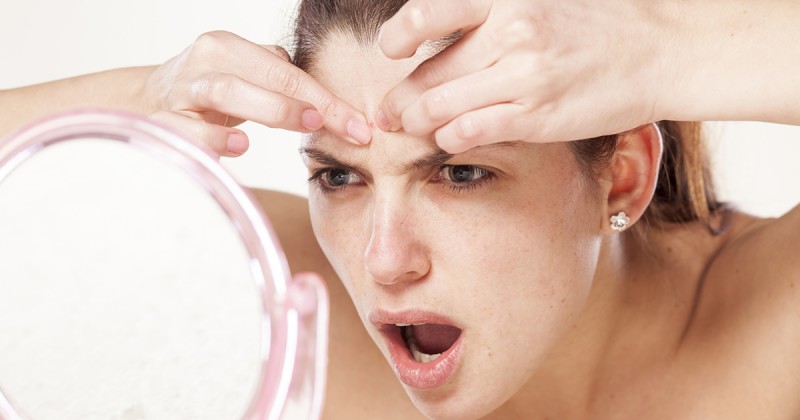 4 tips mot acne