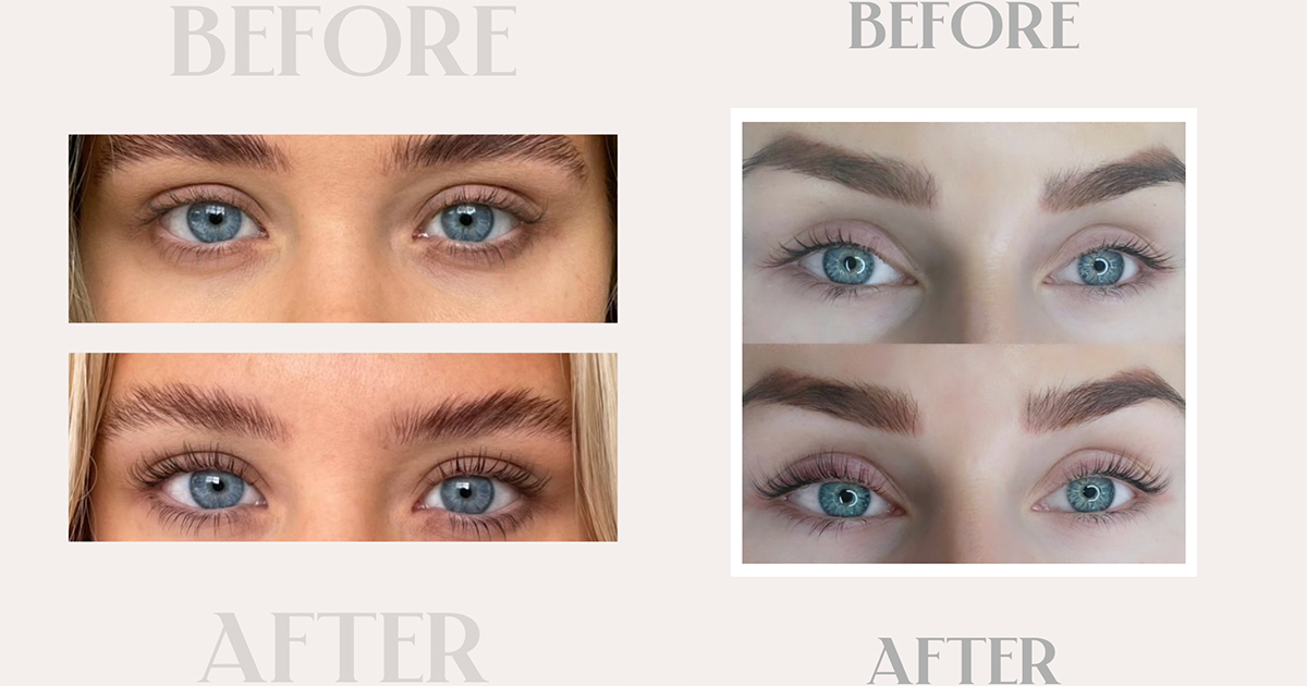 Två bilder på resultat före och efter användning av Xlash. Före efter bilder Xlash Pro ögonfransserum.